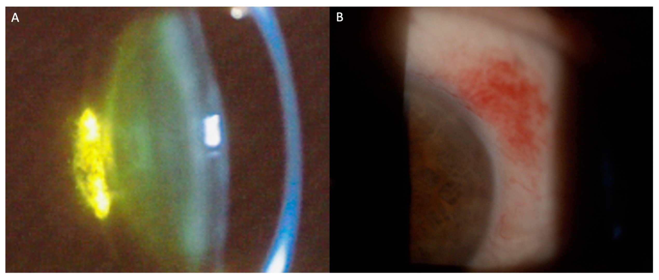 Hematolrep 16 00020 g002