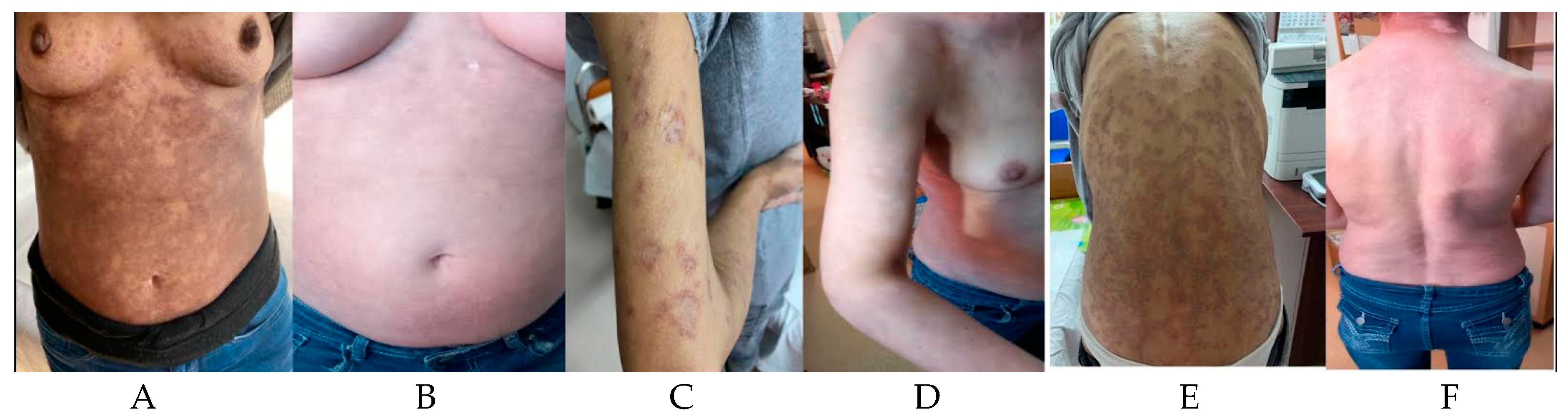 Hematolrep 16 00030 g001