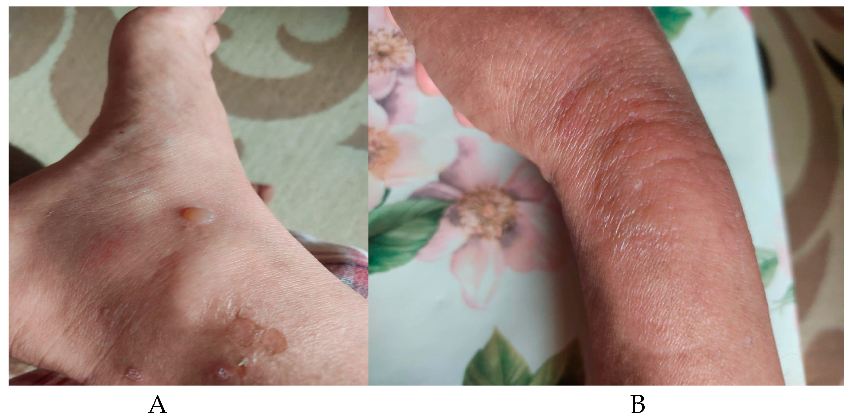 Hematolrep 16 00030 g002