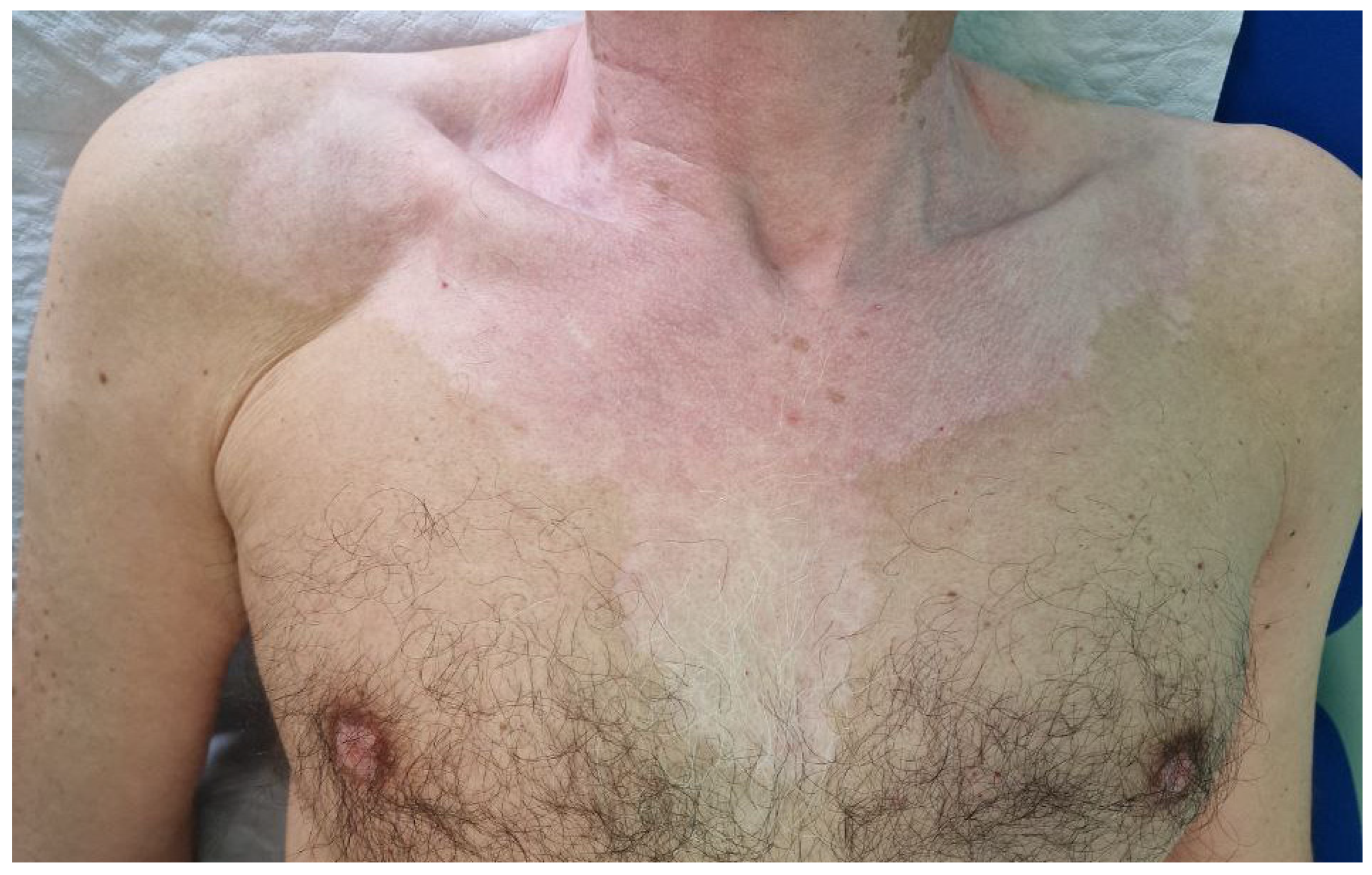 Hematolrep 16 00036 g001