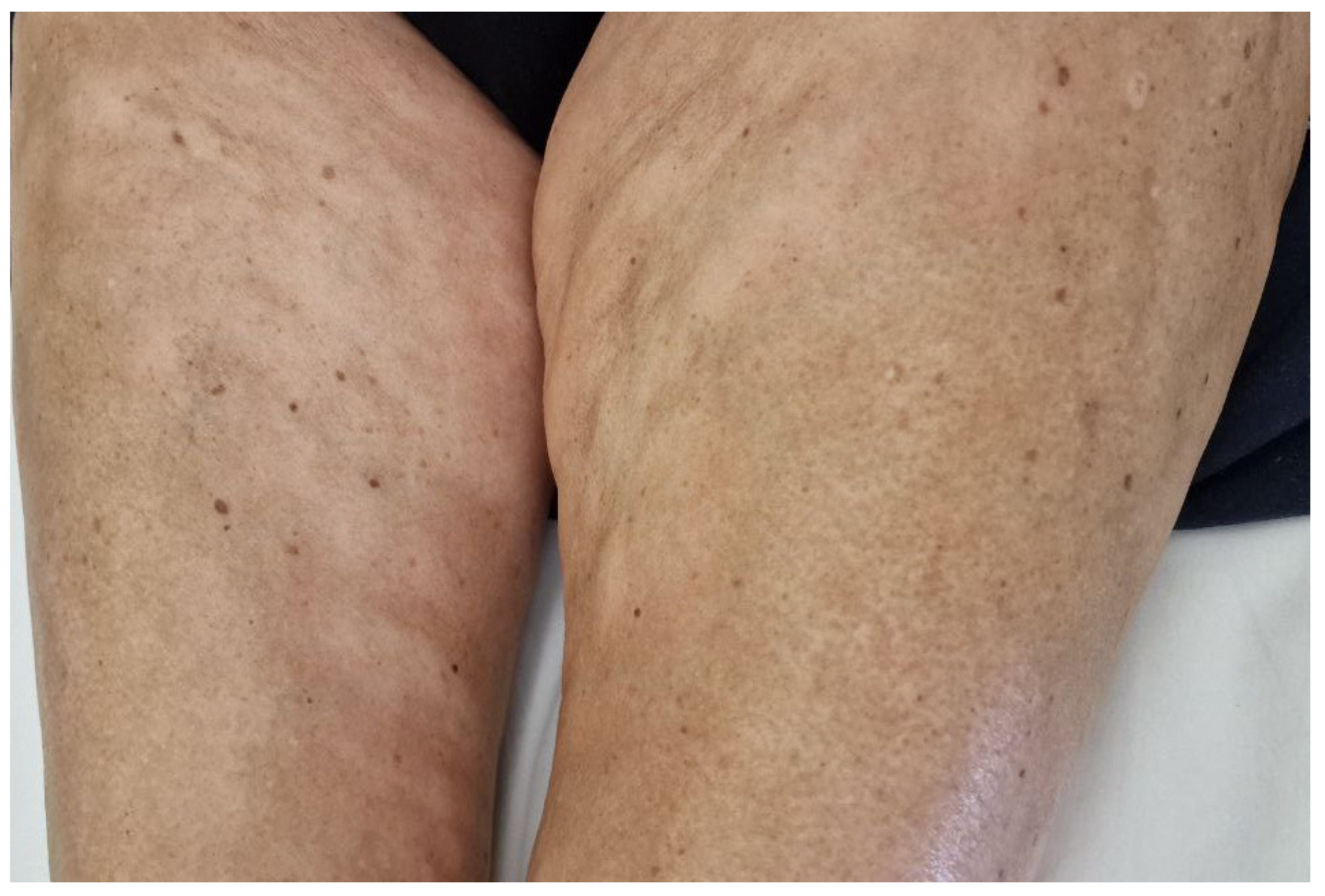 Hematolrep 16 00036 g002