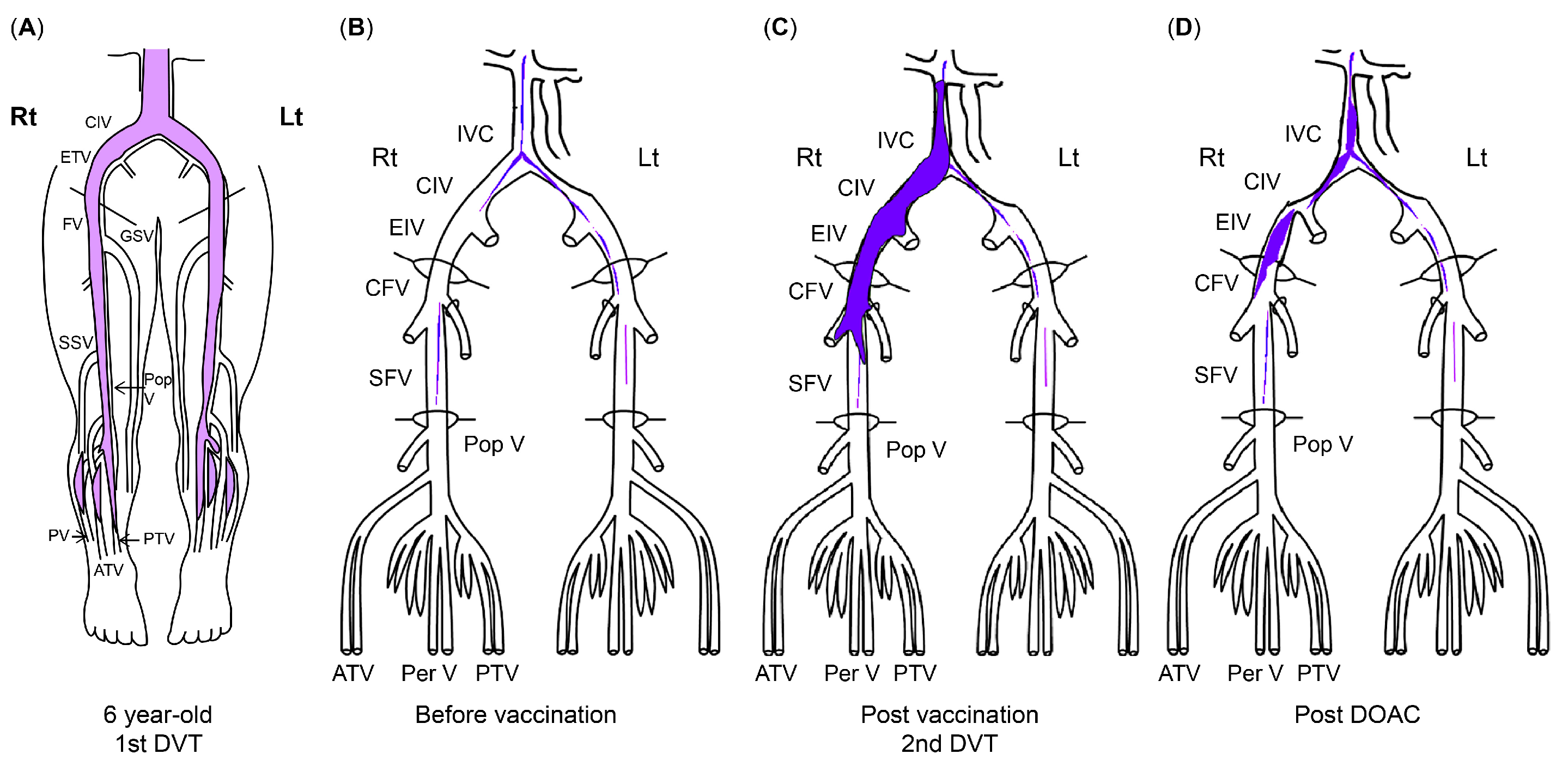 Hematolrep 16 00048 g003
