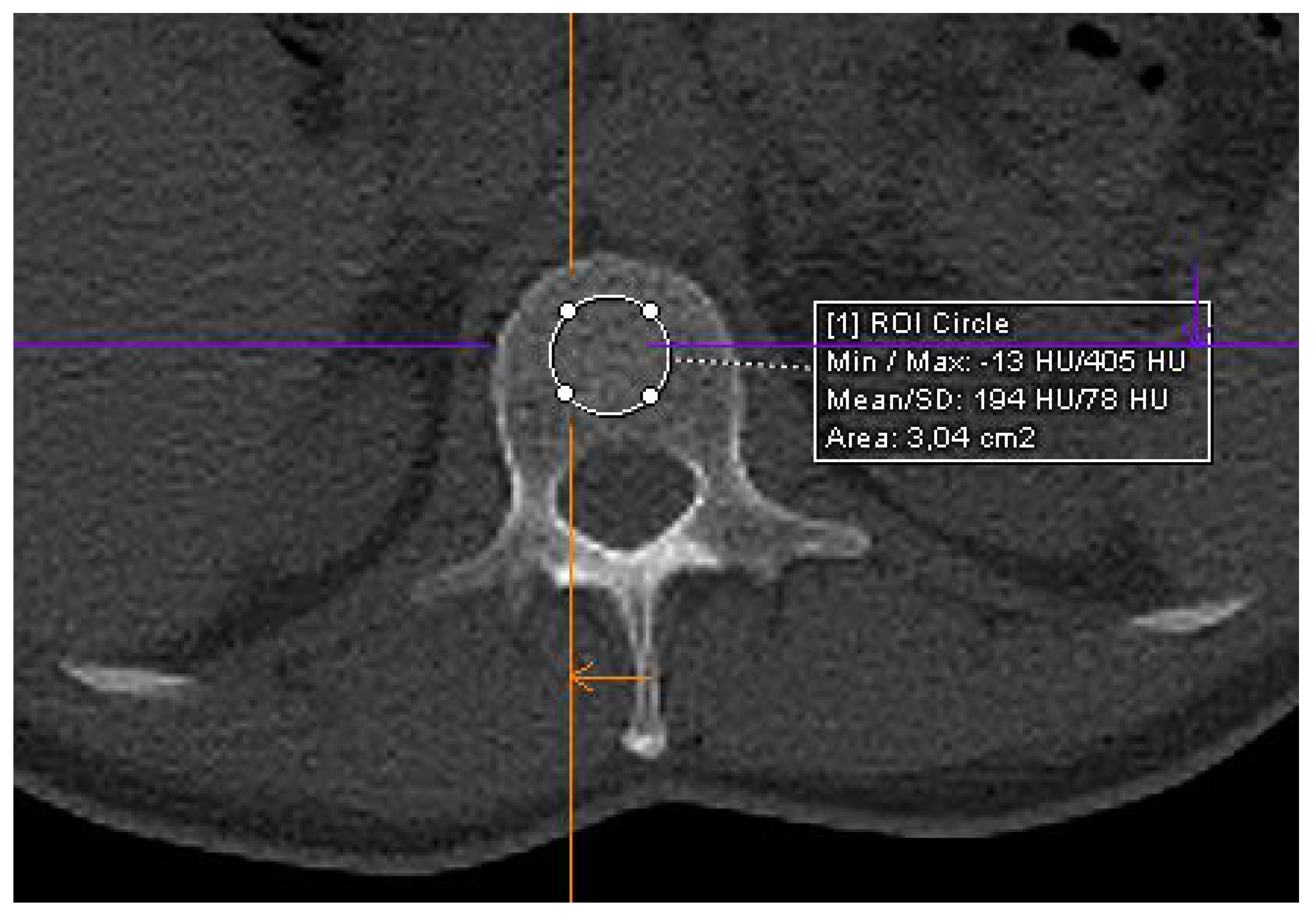 Hematolrep 16 00061 g001 Hematolrep 16 00061 g001