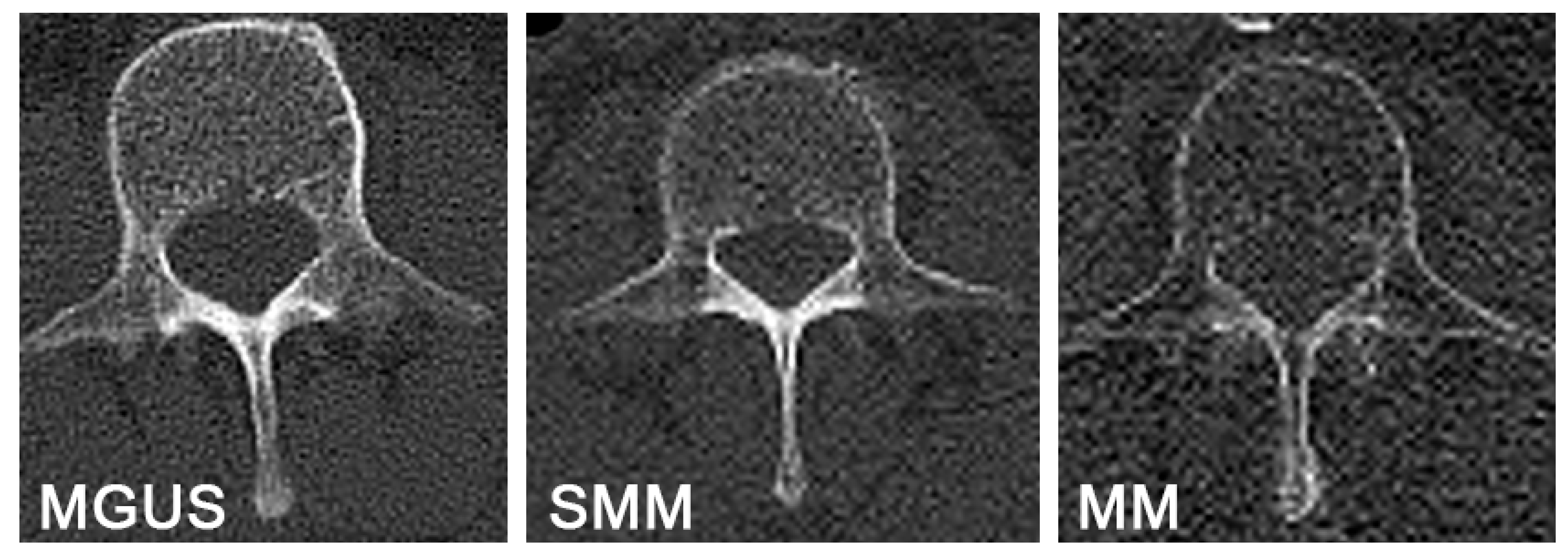 Hematolrep 16 00061 g004 Hematolrep 16 00061 g004