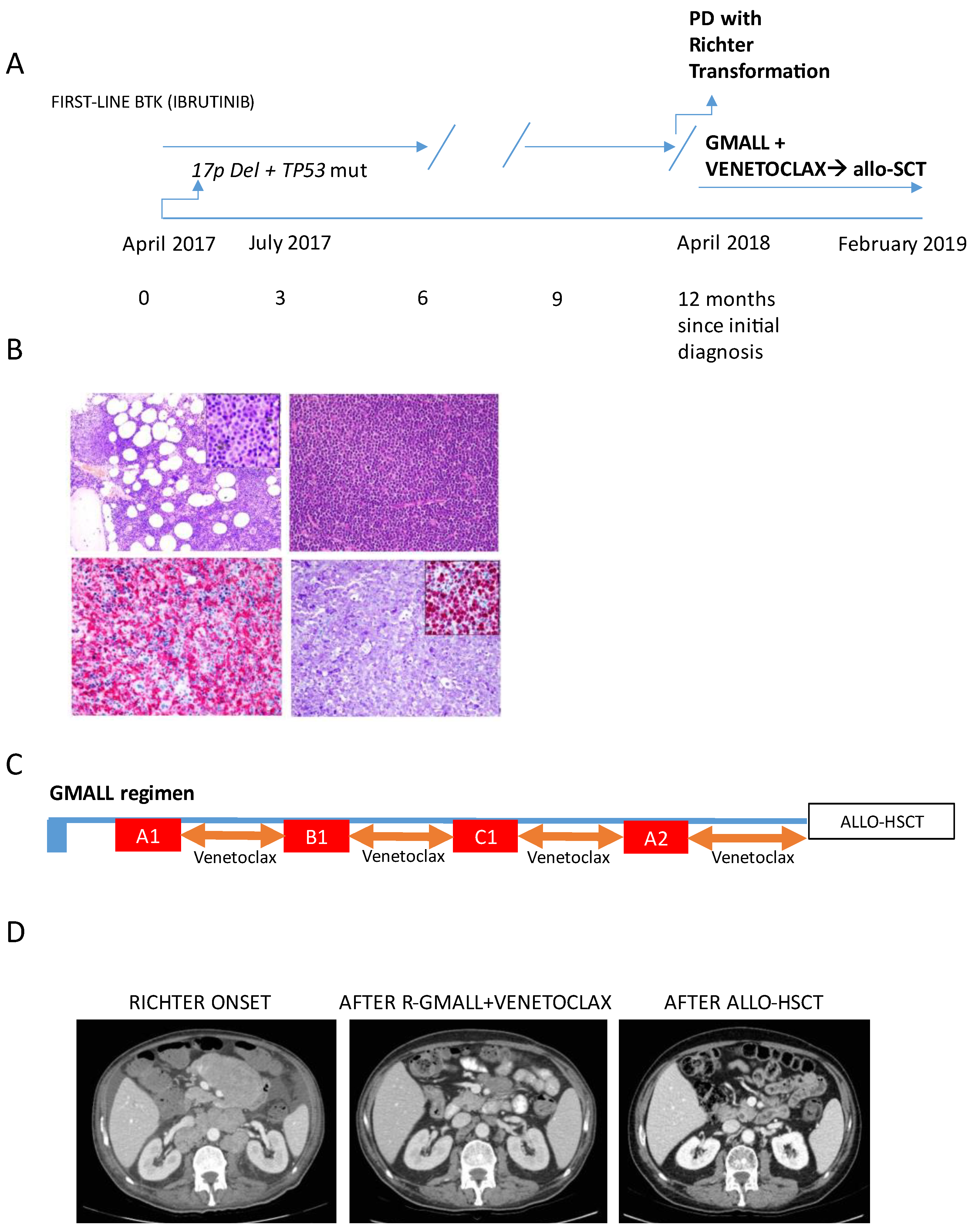 Hematolrep 16 00075 g001