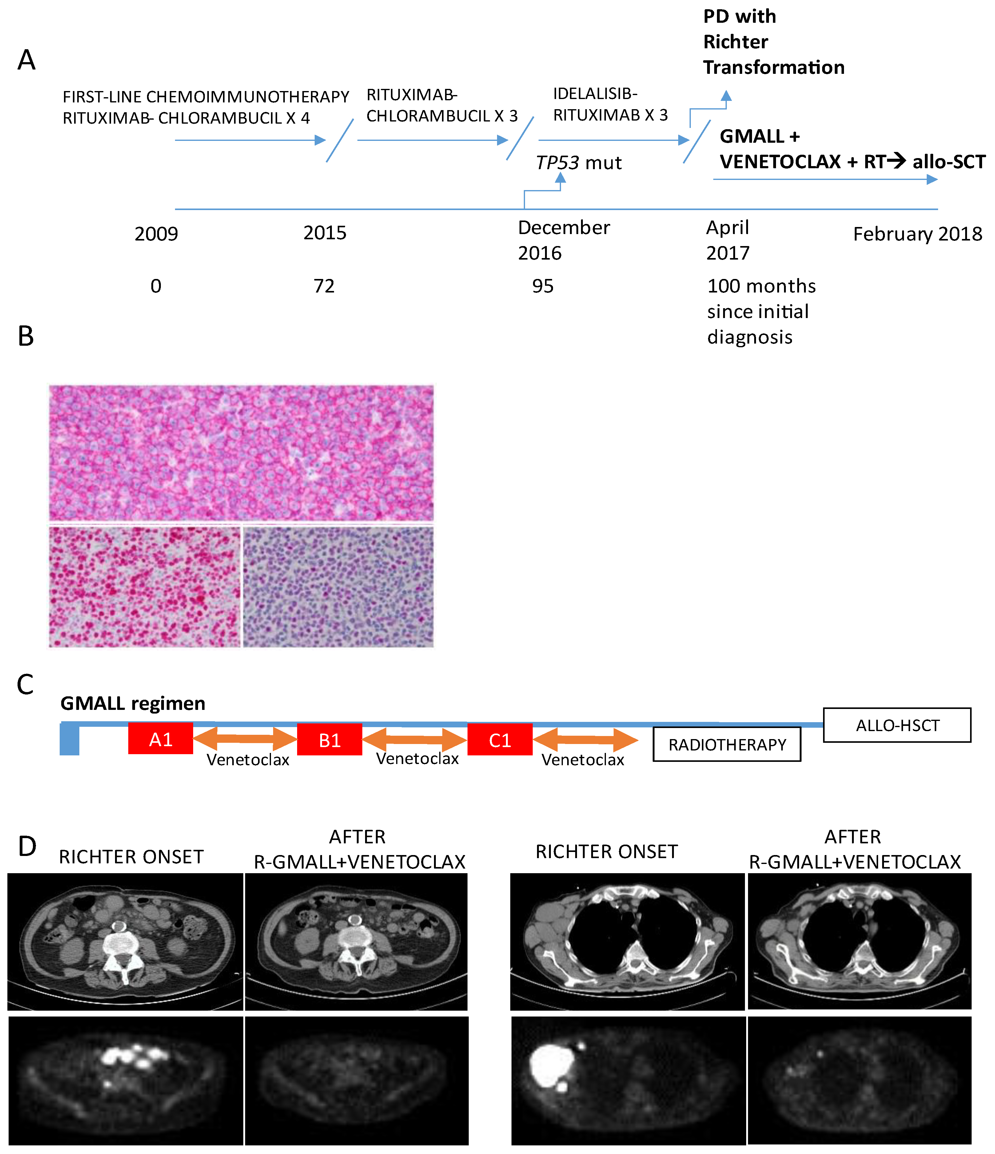 Hematolrep 16 00075 g002