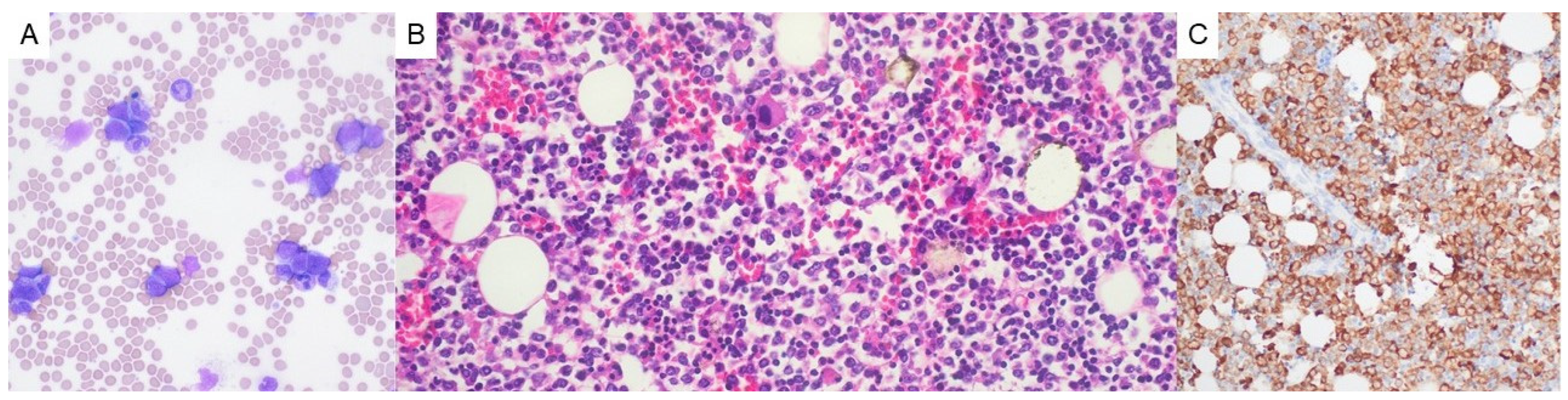 Hematolrep 17 00014 g003 Hematolrep 17 00014 g003