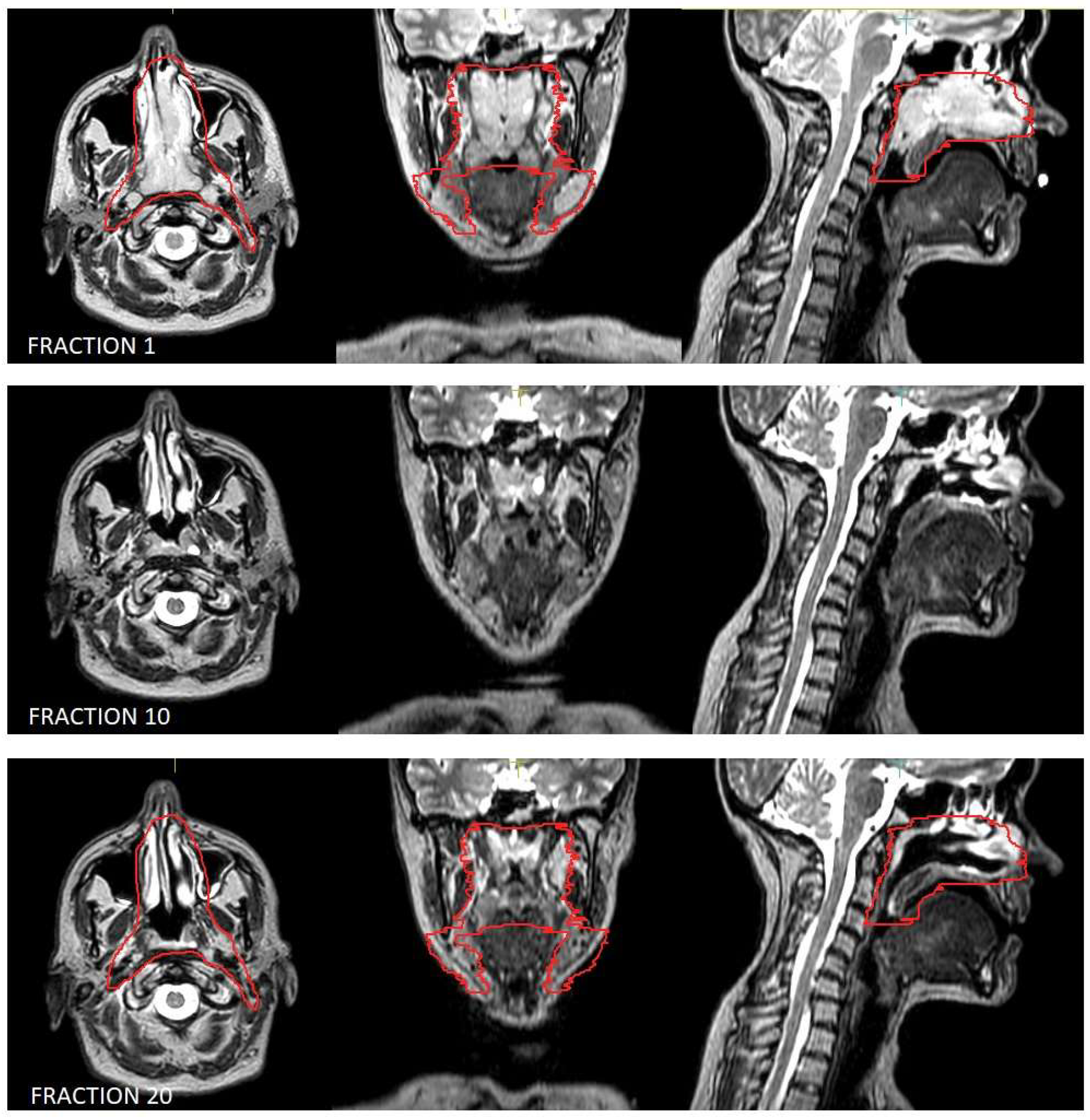 Hematolrep 17 00016 g001