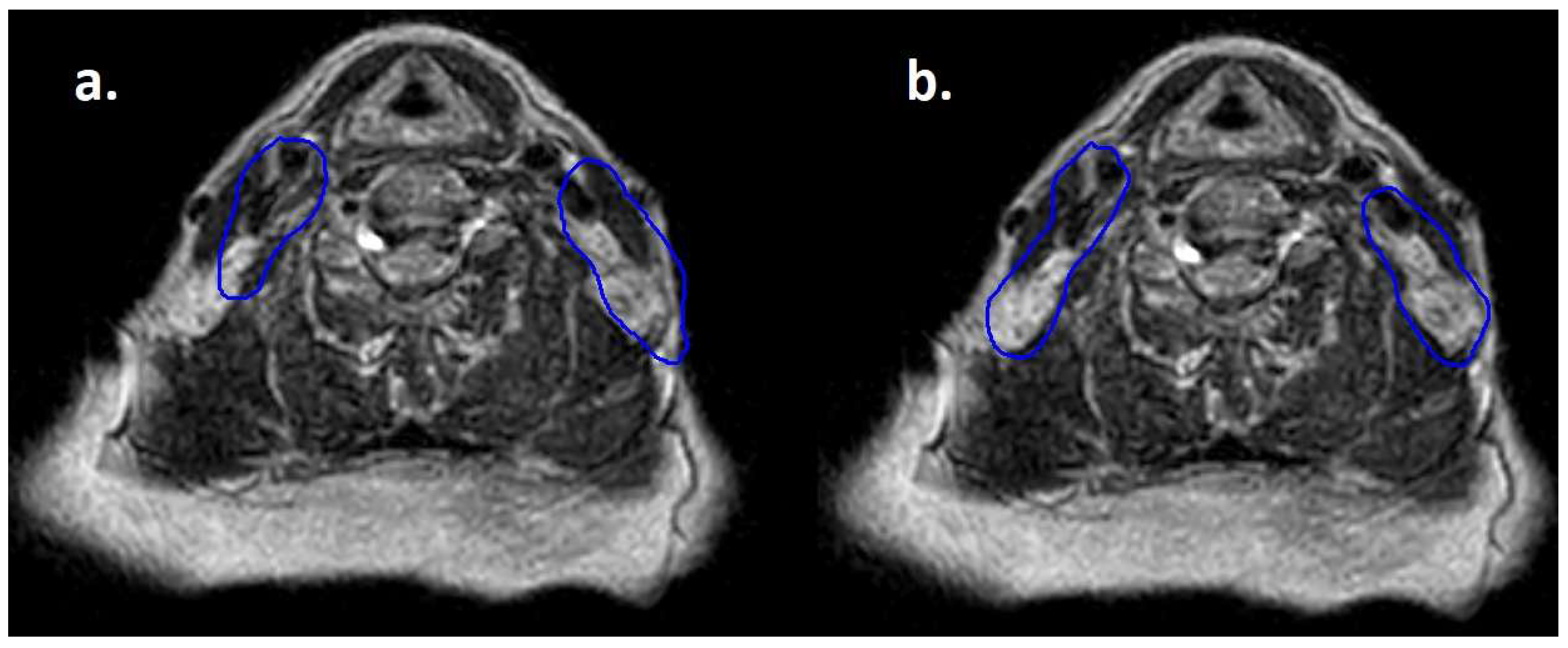 Hematolrep 17 00016 g002