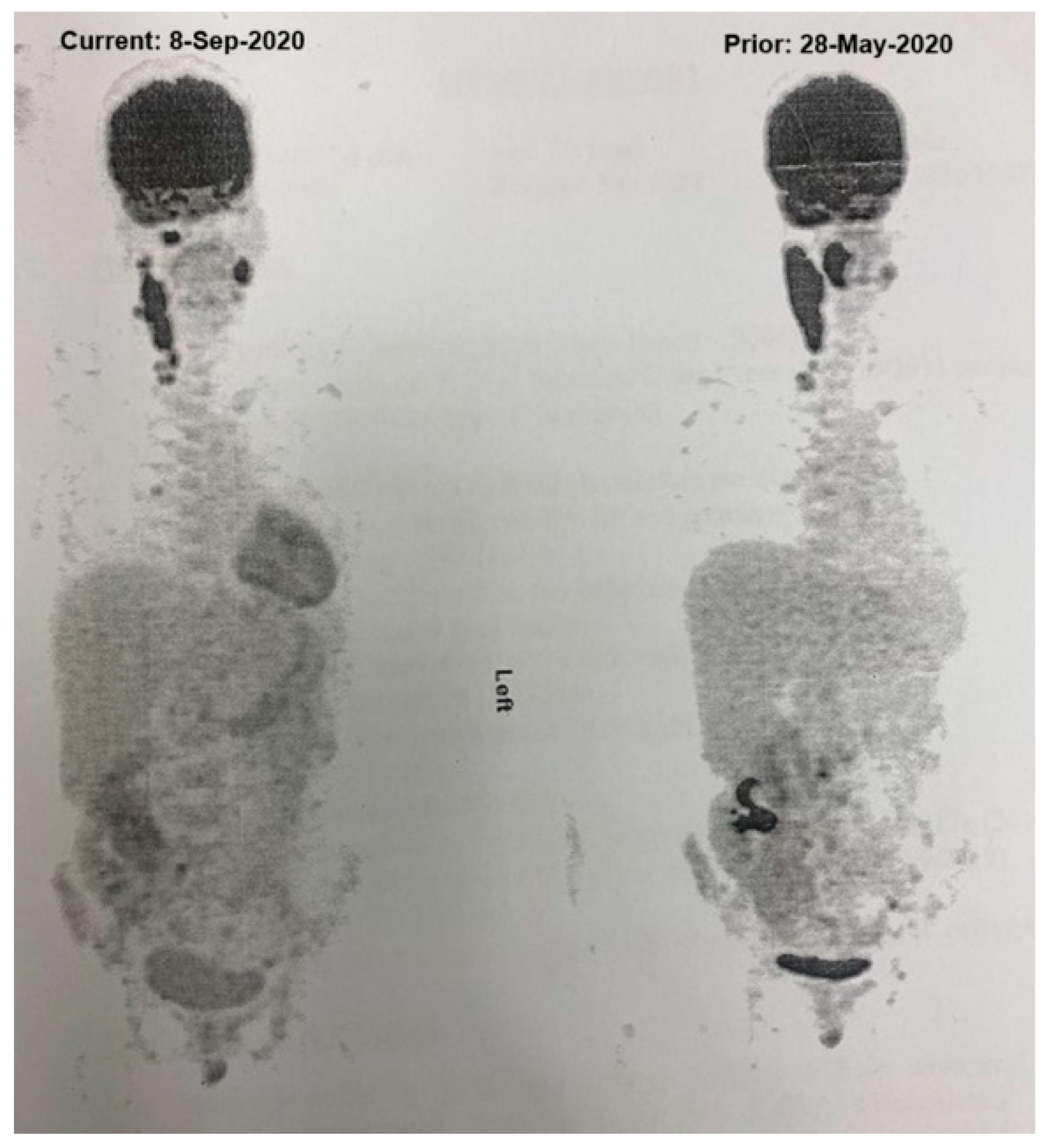 Hematolrep 17 00022 g001
