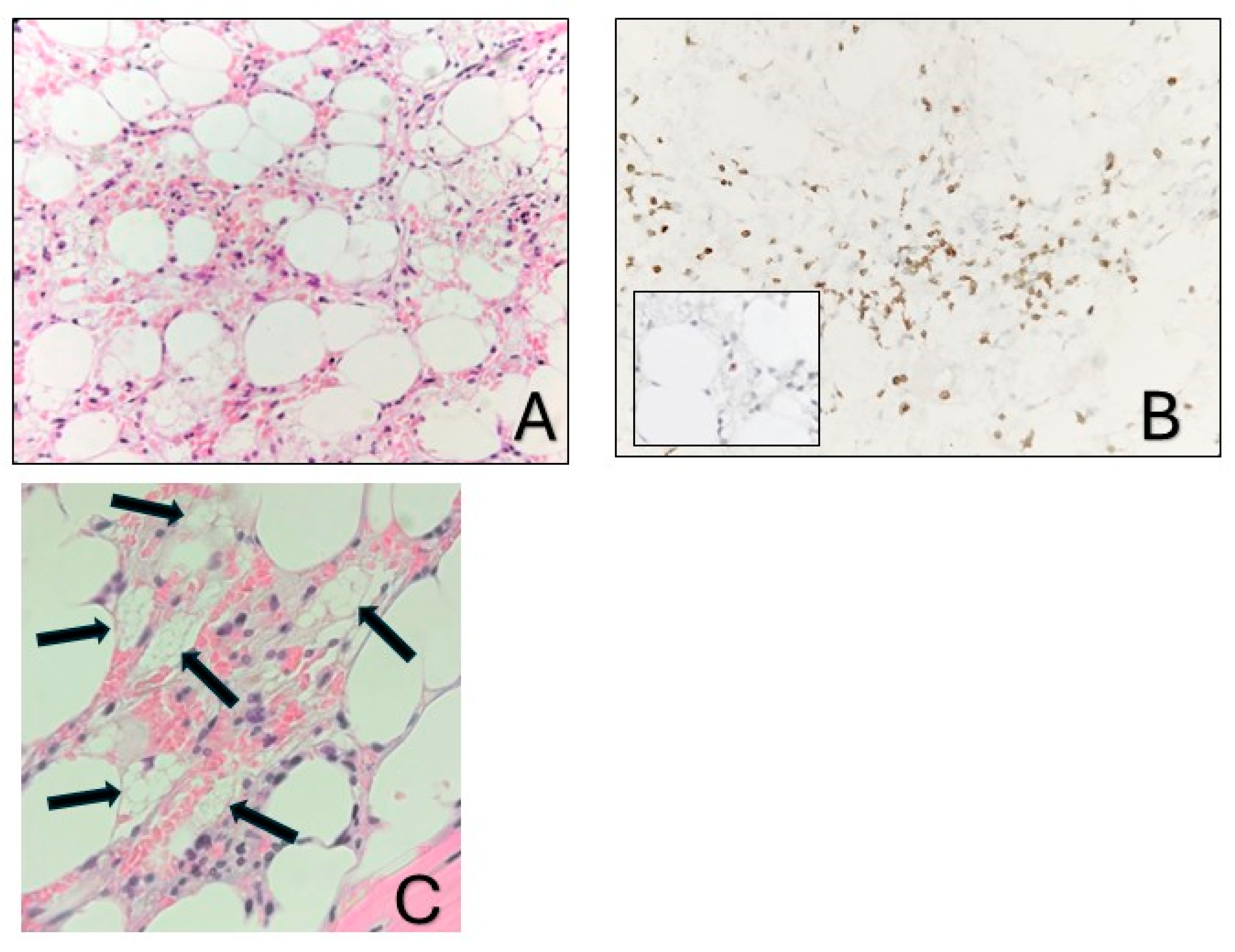 Hematolrep 17 00025 g001