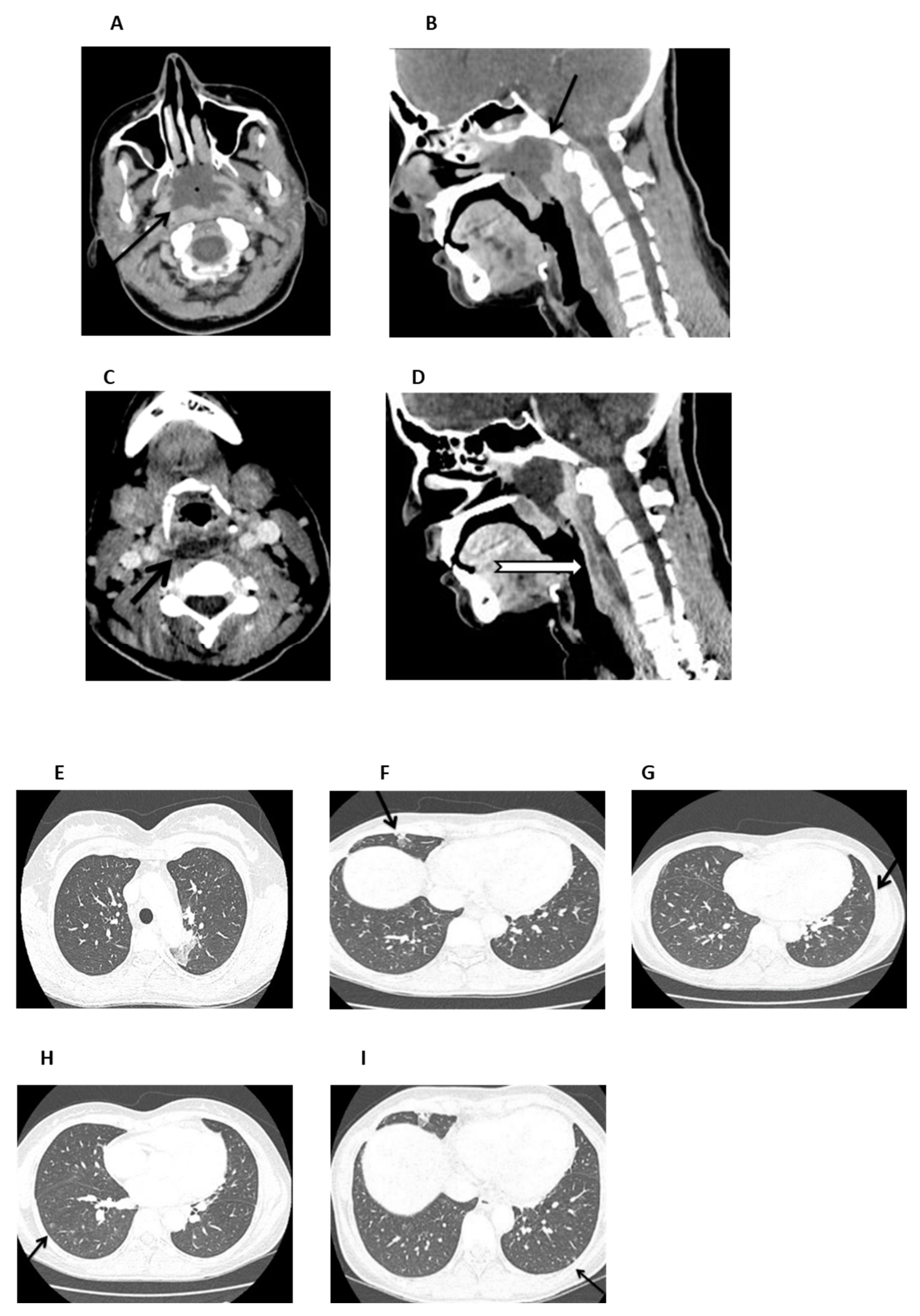 Hematolrep 17 00025 g003