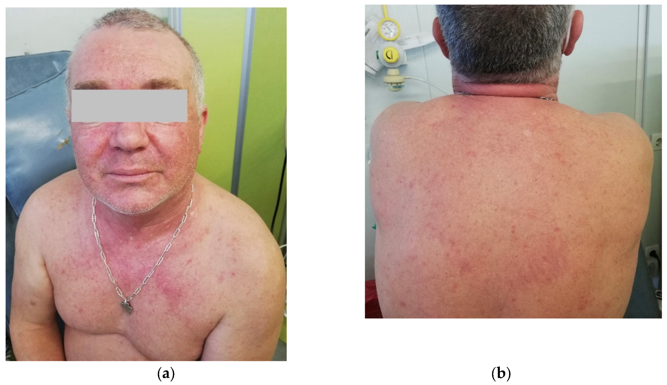 Hematolrep 17 00029 g001