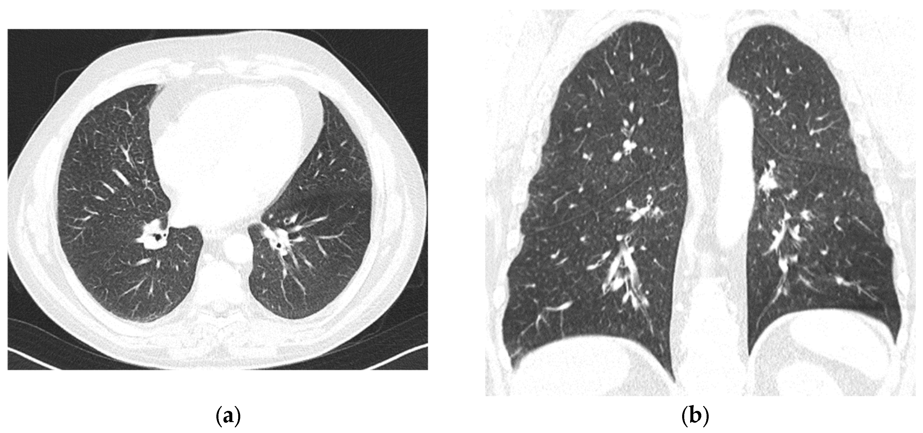 Hematolrep 17 00029 g002