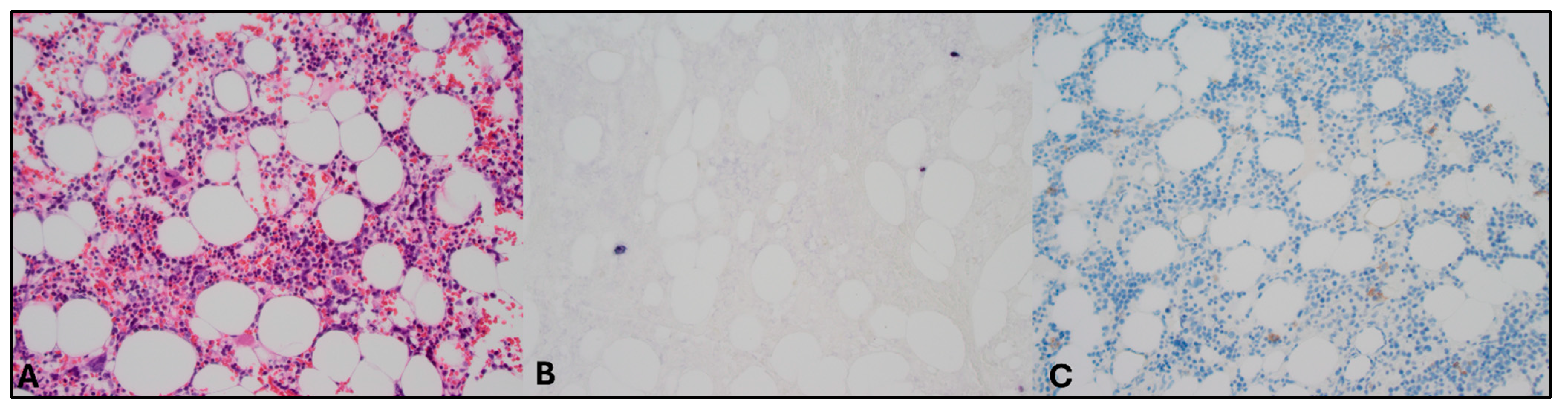 Hematolrep 17 00040 g002