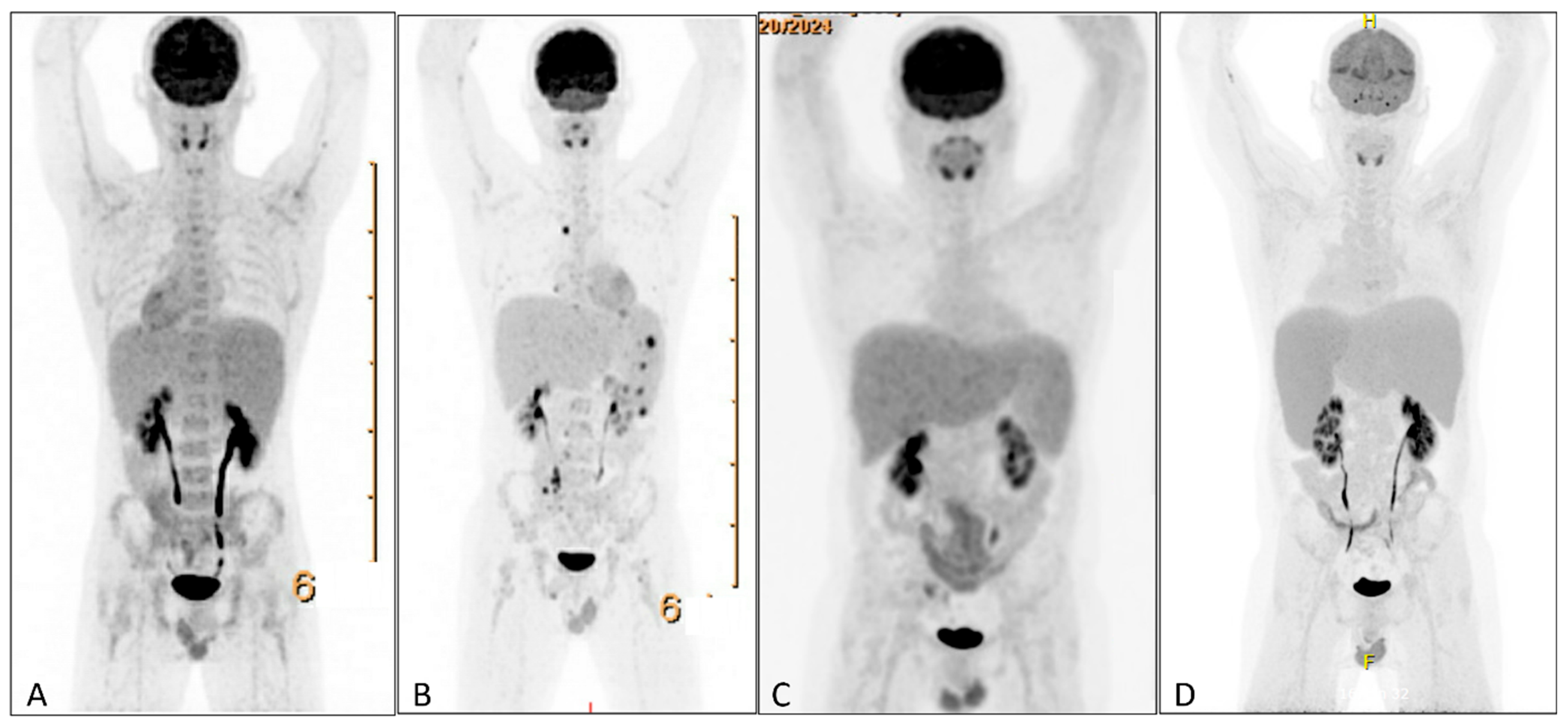 Hematolrep 17 00040 g003