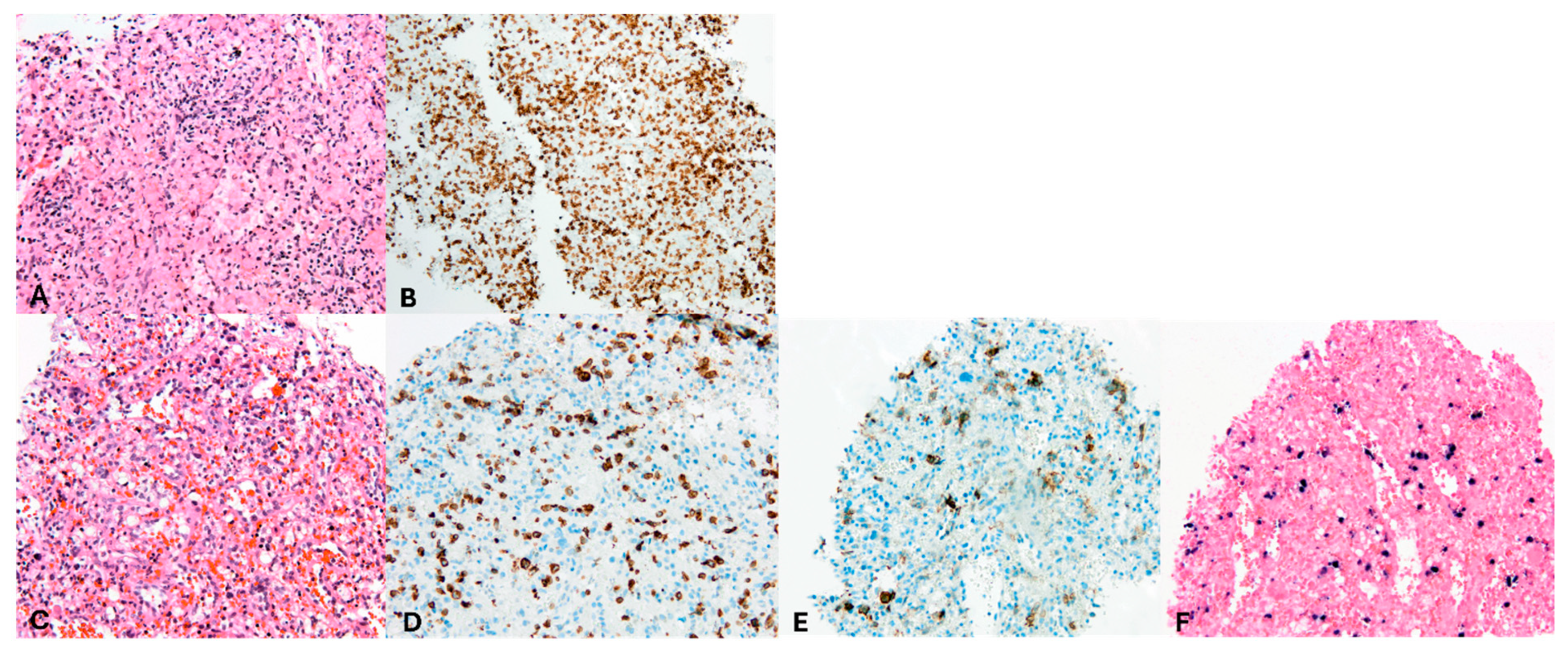 Hematolrep 17 00040 g004