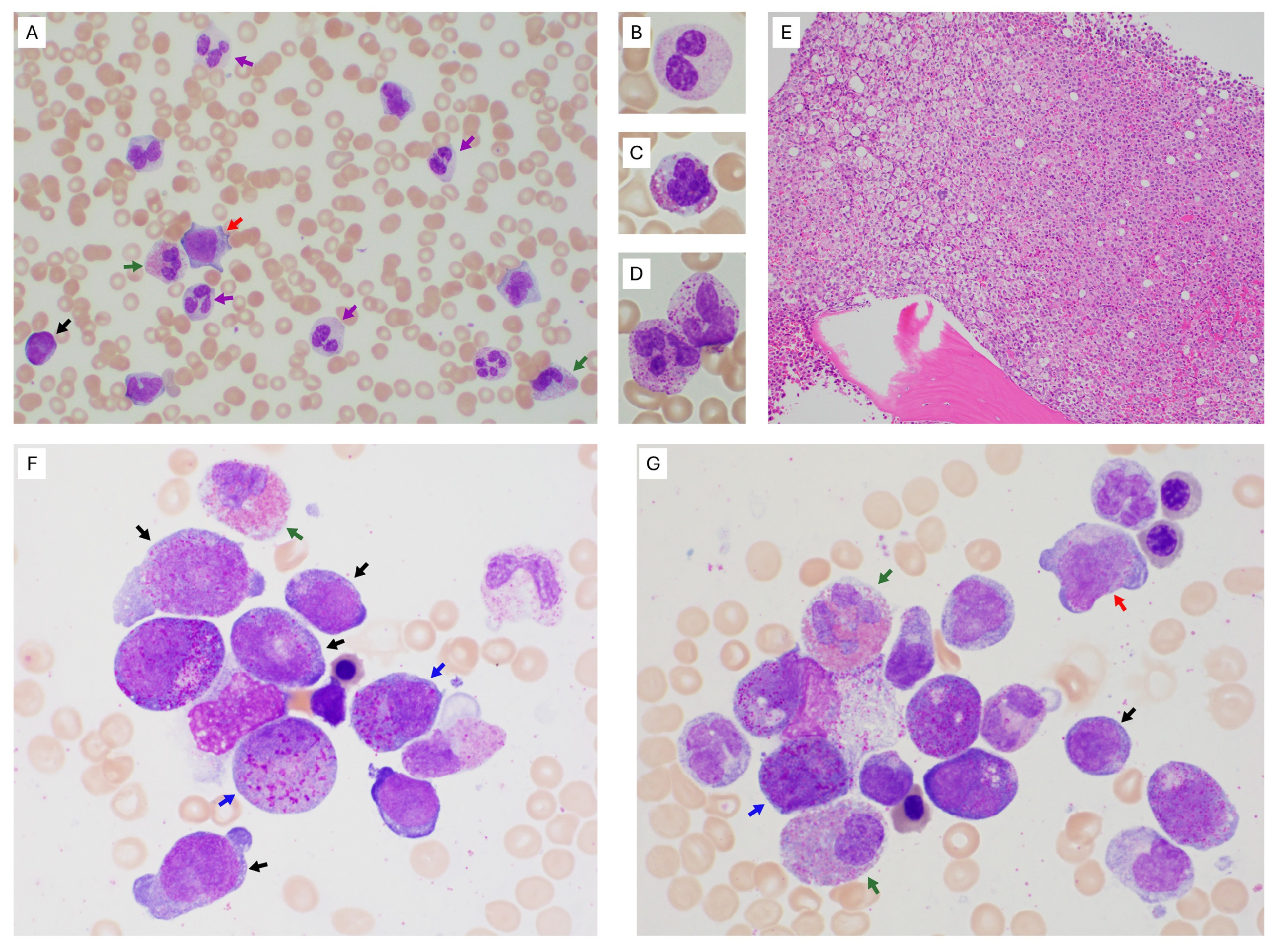 Hematolrep 18 00024 g001