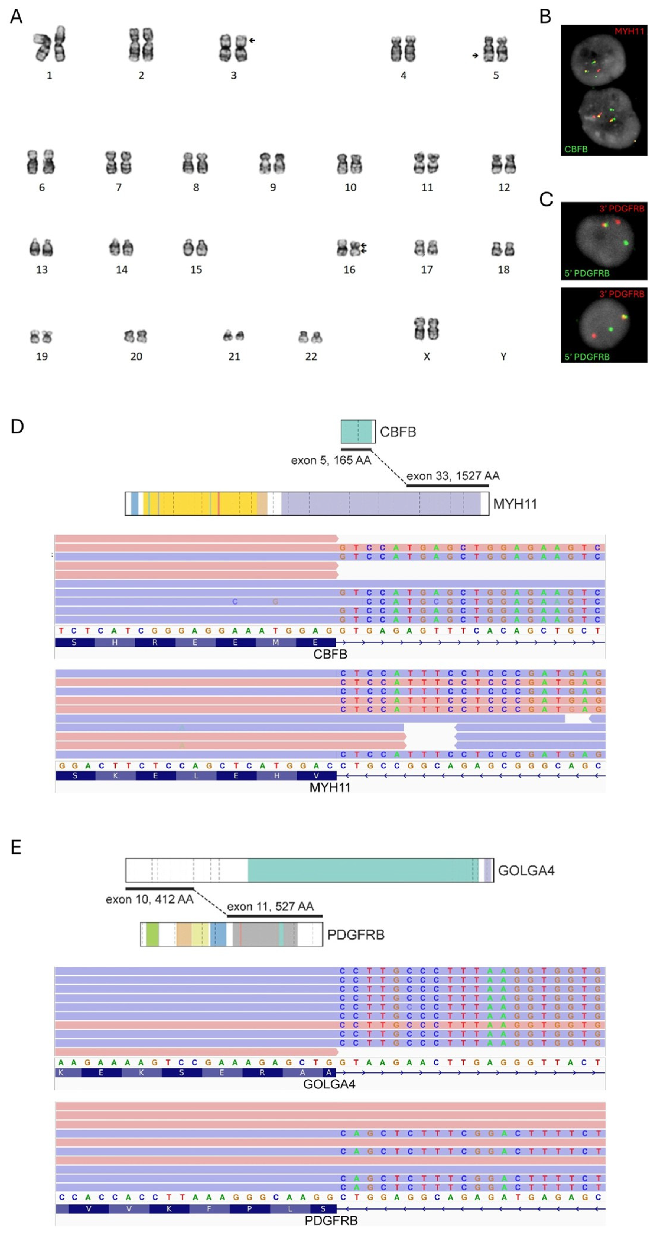 Hematolrep 18 00024 g002