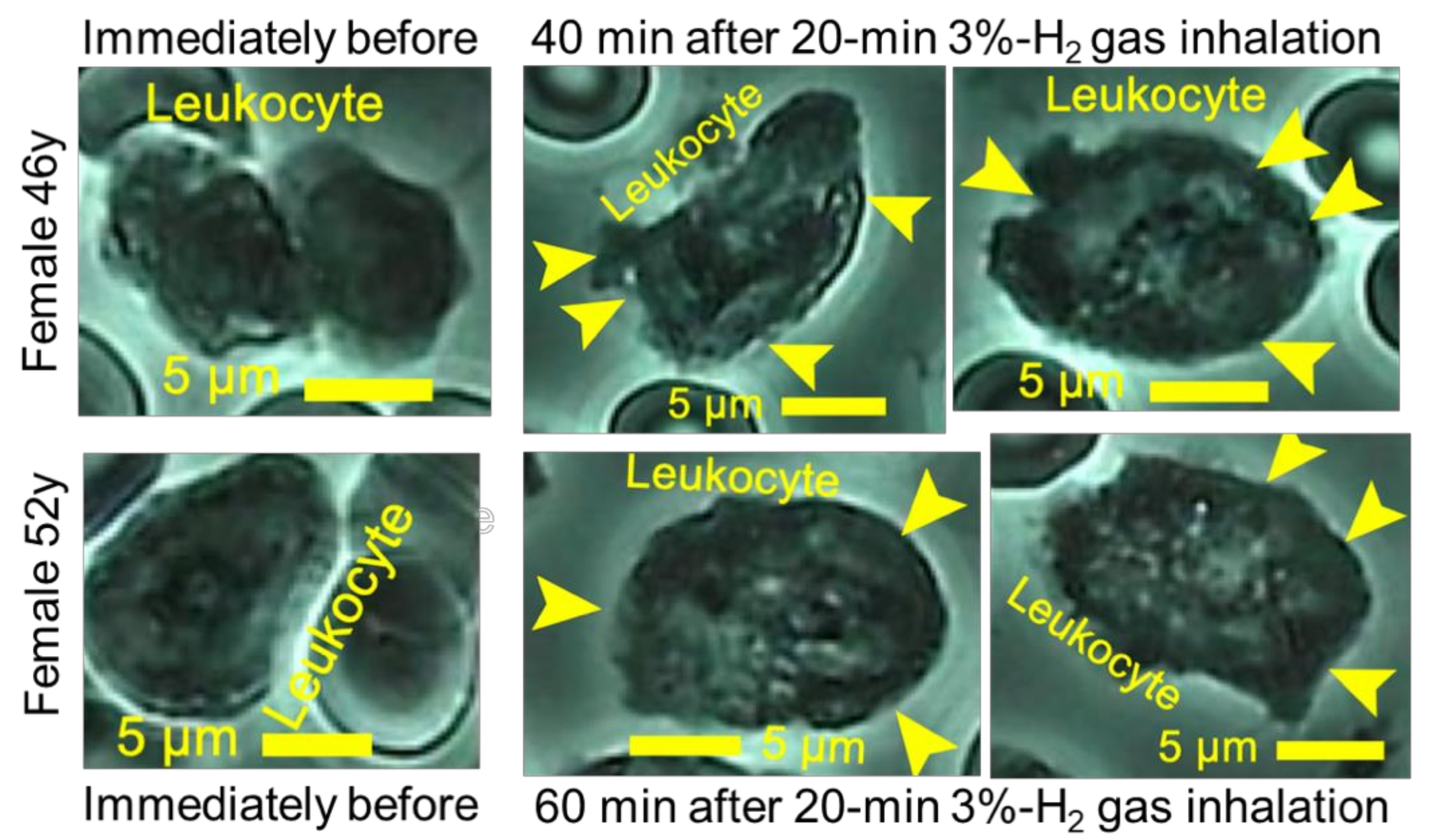 Hydrogen 03 00006 g005