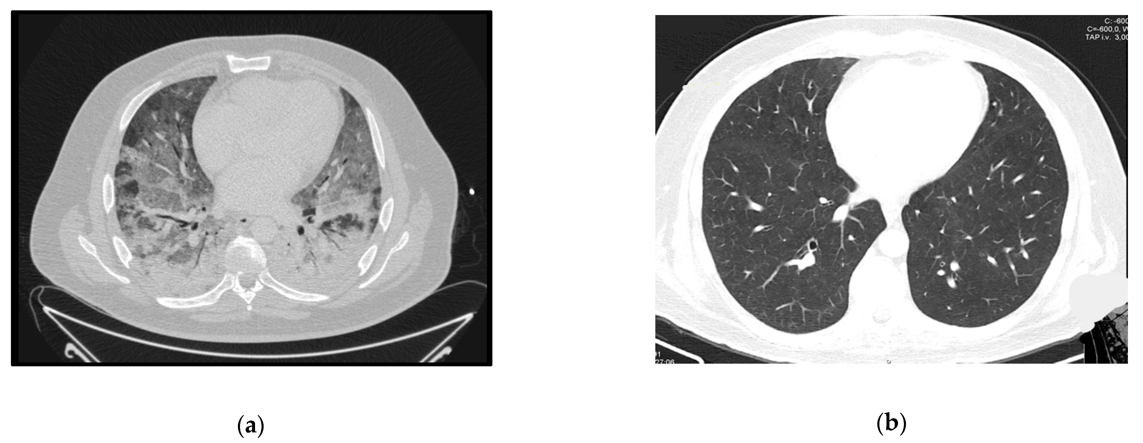 Idr 13 00092 g004 Idr 13 00092 g004