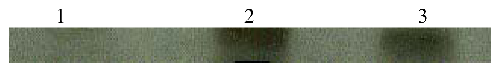Ijerph 02 00107f2