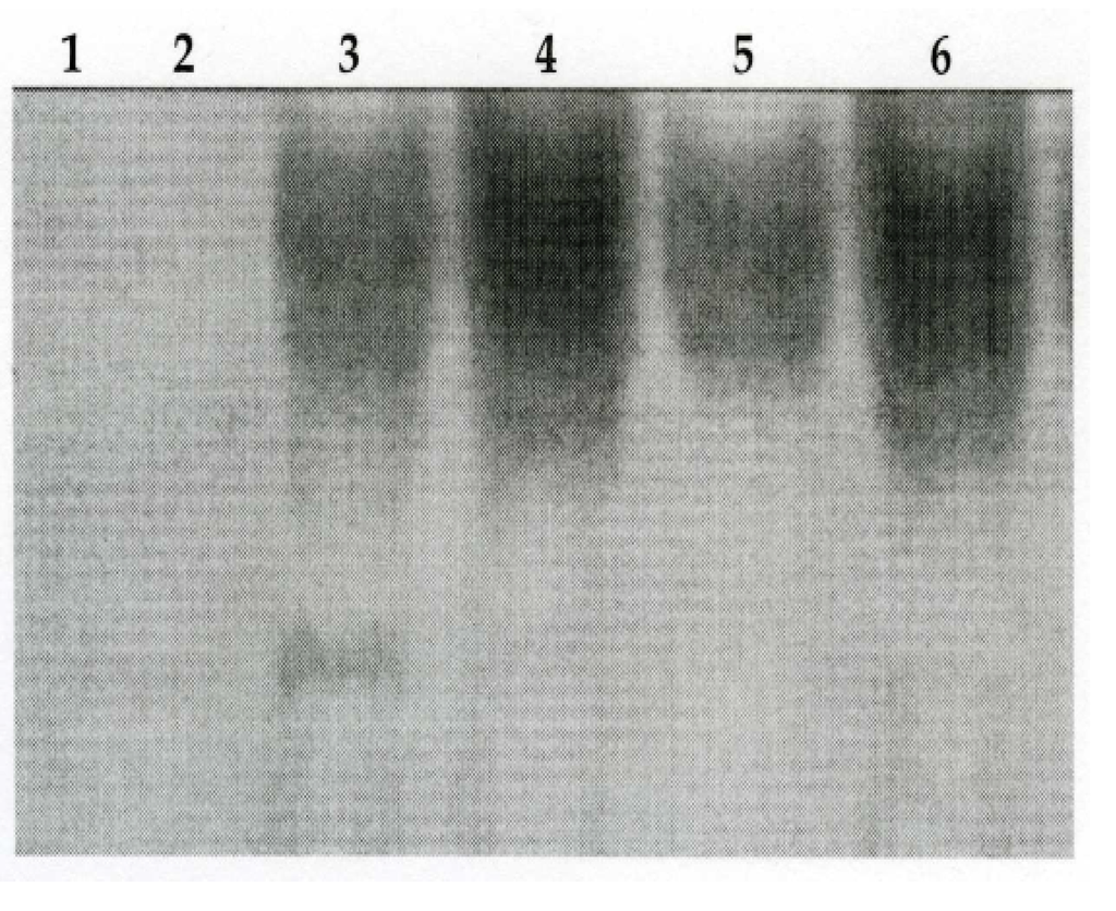 Ijerph 02 00403 g004 1024