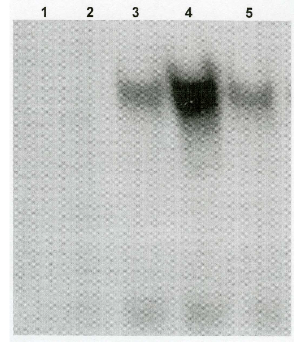 Ijerph 02 00403 g005 1024