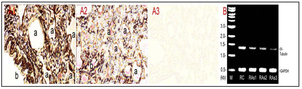 Ijerph 09 00474 g004