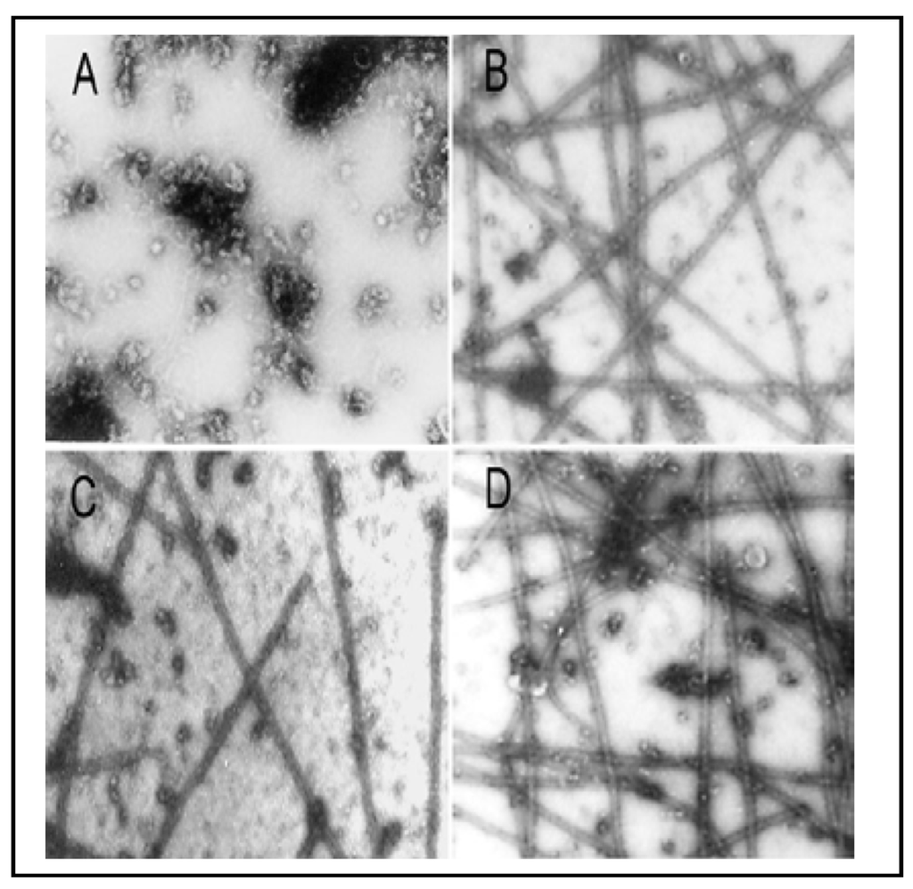 Ijerph 09 00474 g006 1024