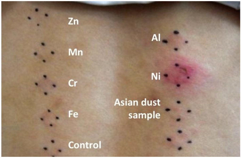 Ijerph 09 04606 g003 1024