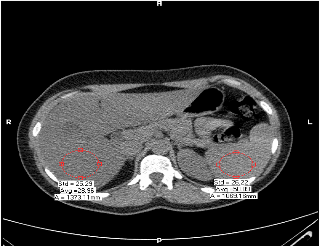 Ijerph 10 03409 g001 1024