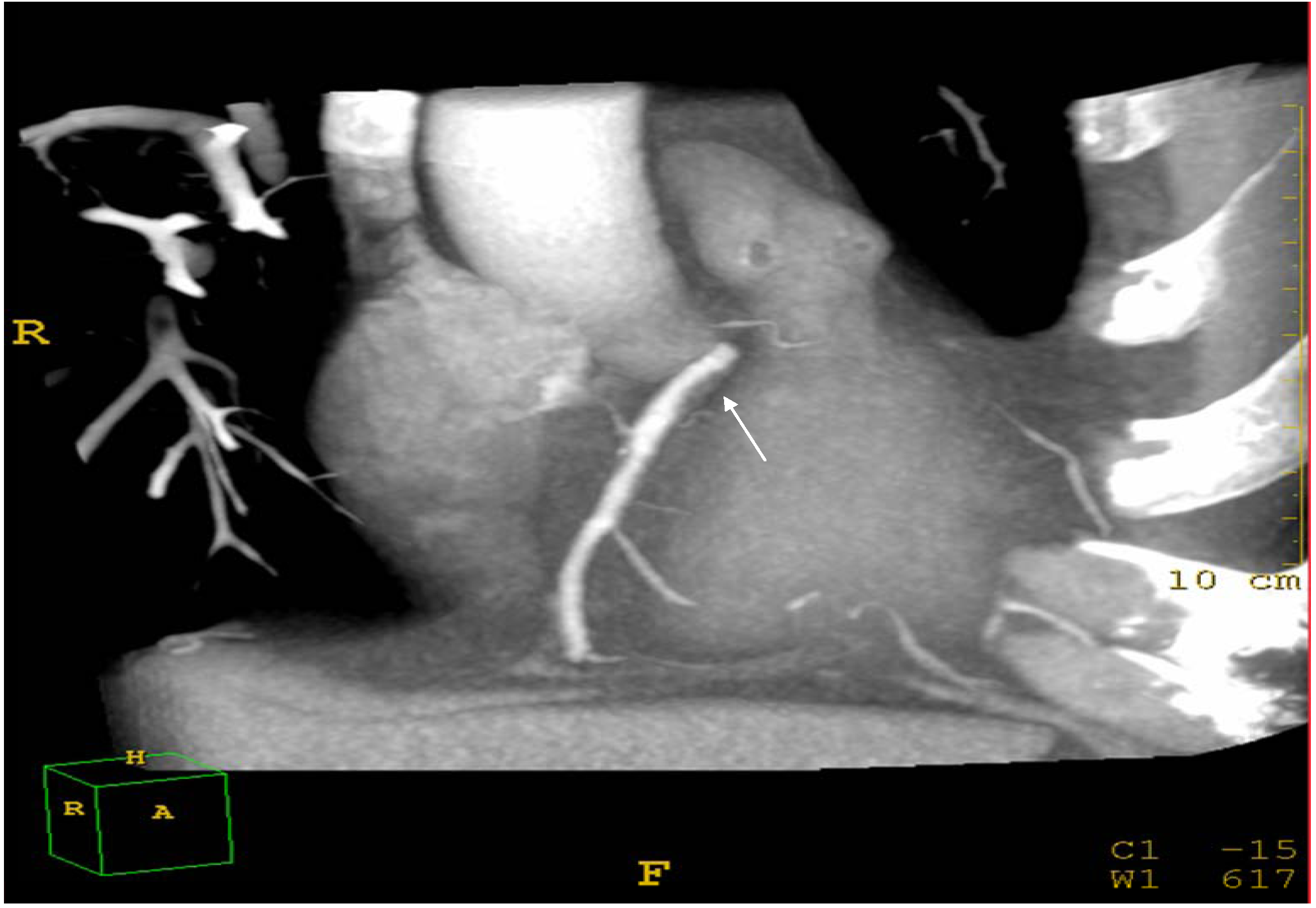 Ijerph 10 03409 g003