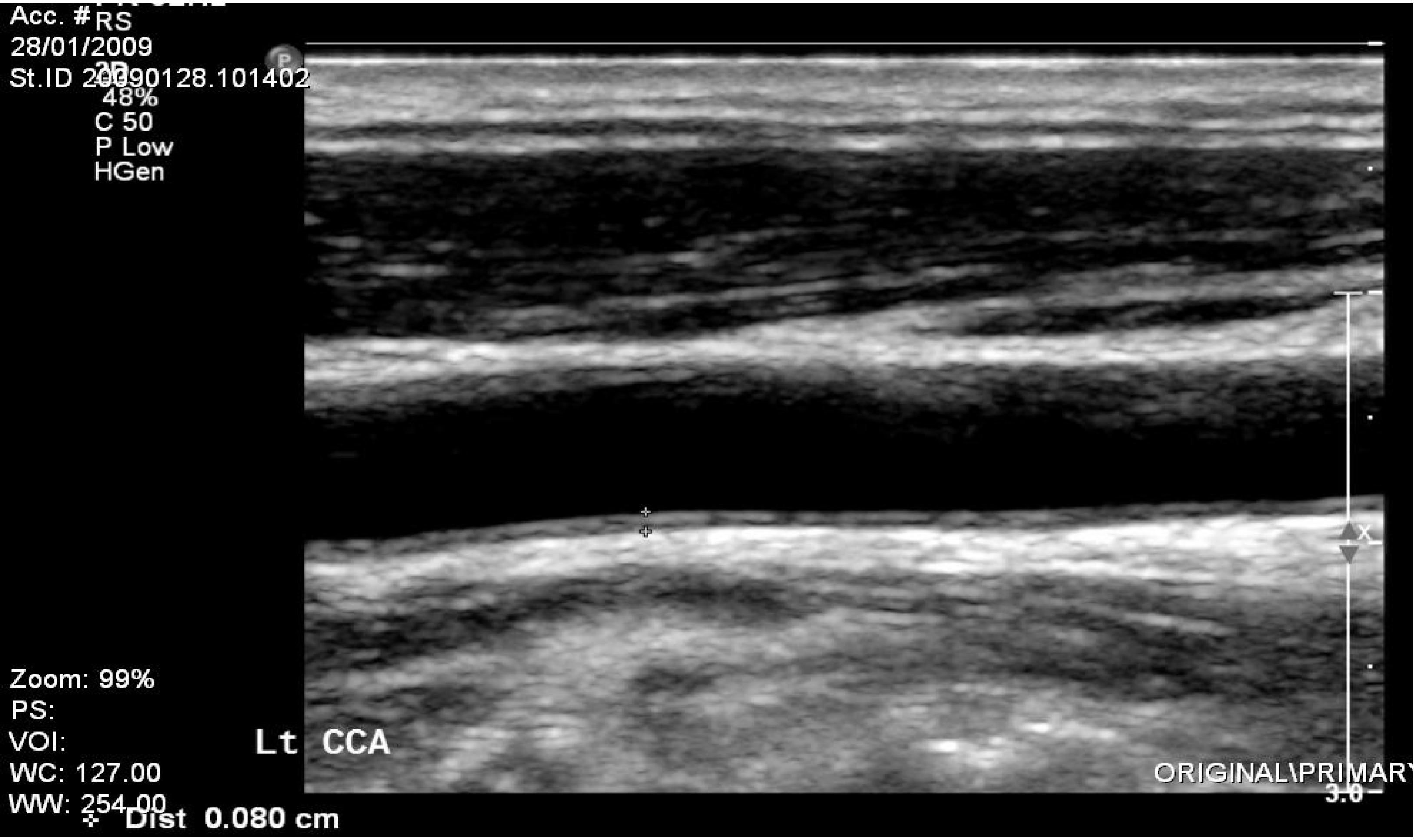 Ijerph 10 03409 g004