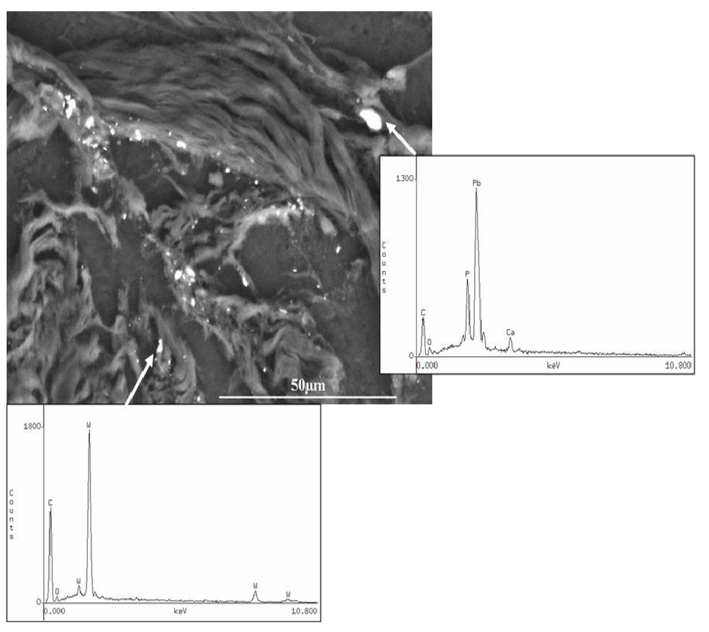 Ijerph 11 01261 g003 1024