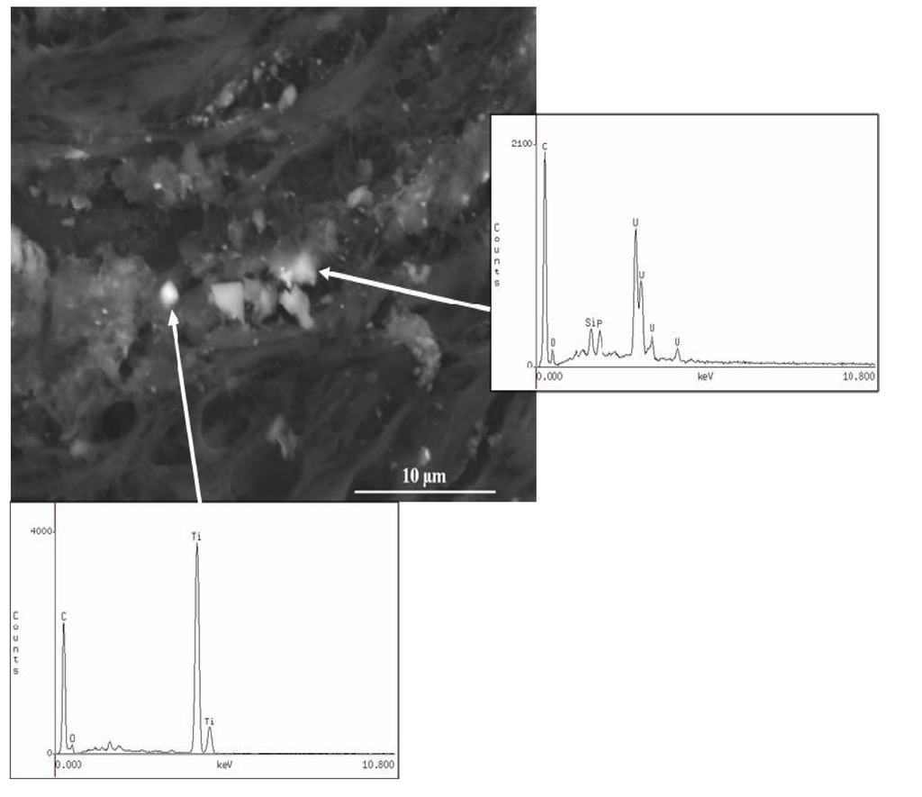 Ijerph 11 01261 g005 1024