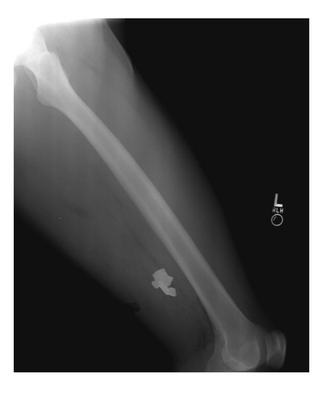 Ijerph 11 01261 g006 1024