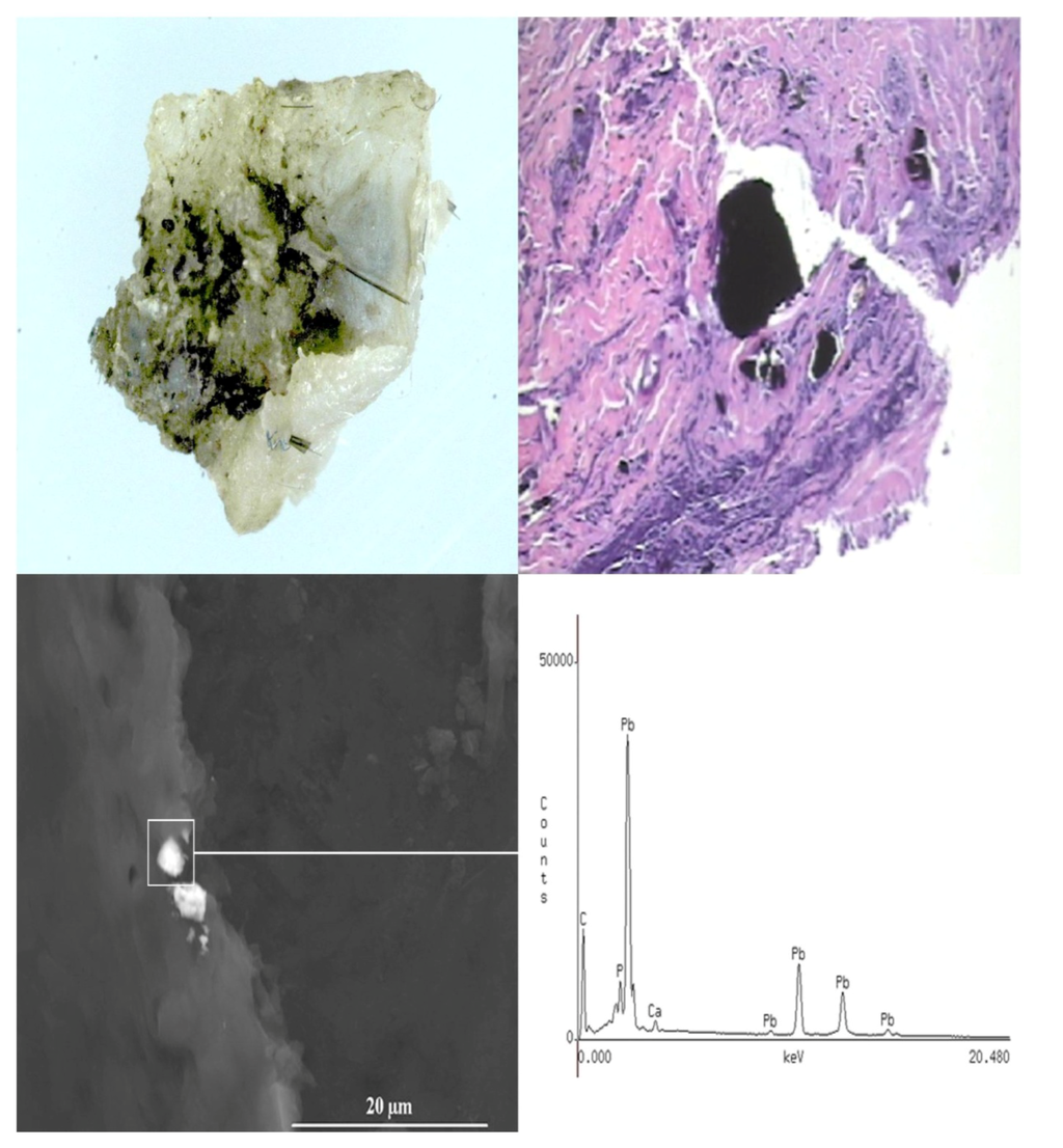 Ijerph 11 01261 g008 1024