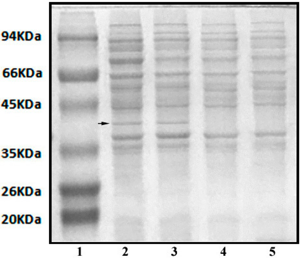 Ijerph 12 04214 g008 1024