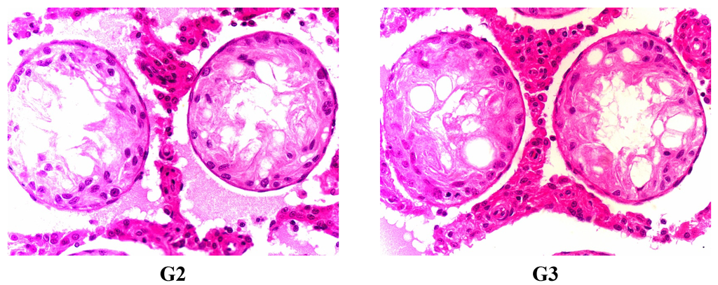 Ijerph 12 04942 g002b 1024