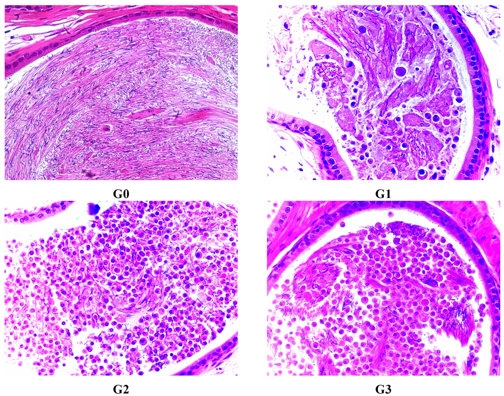 Ijerph 12 04942 g003 1024