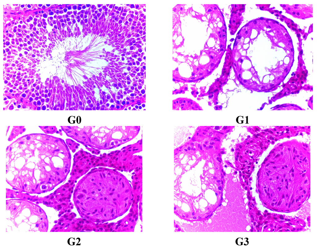 Ijerph 12 04942 g004 1024