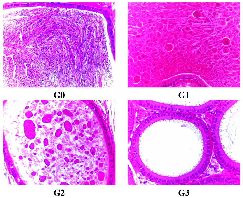 Ijerph 12 04942 g005 1024