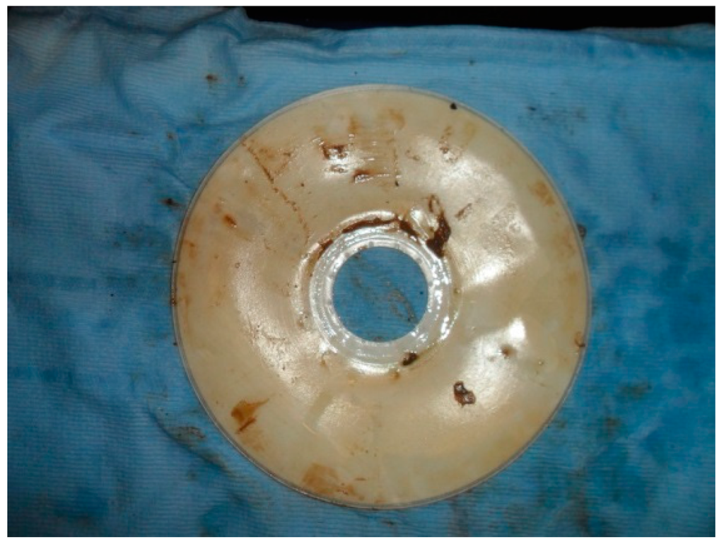 Ijerph 13 00100 g013 1024