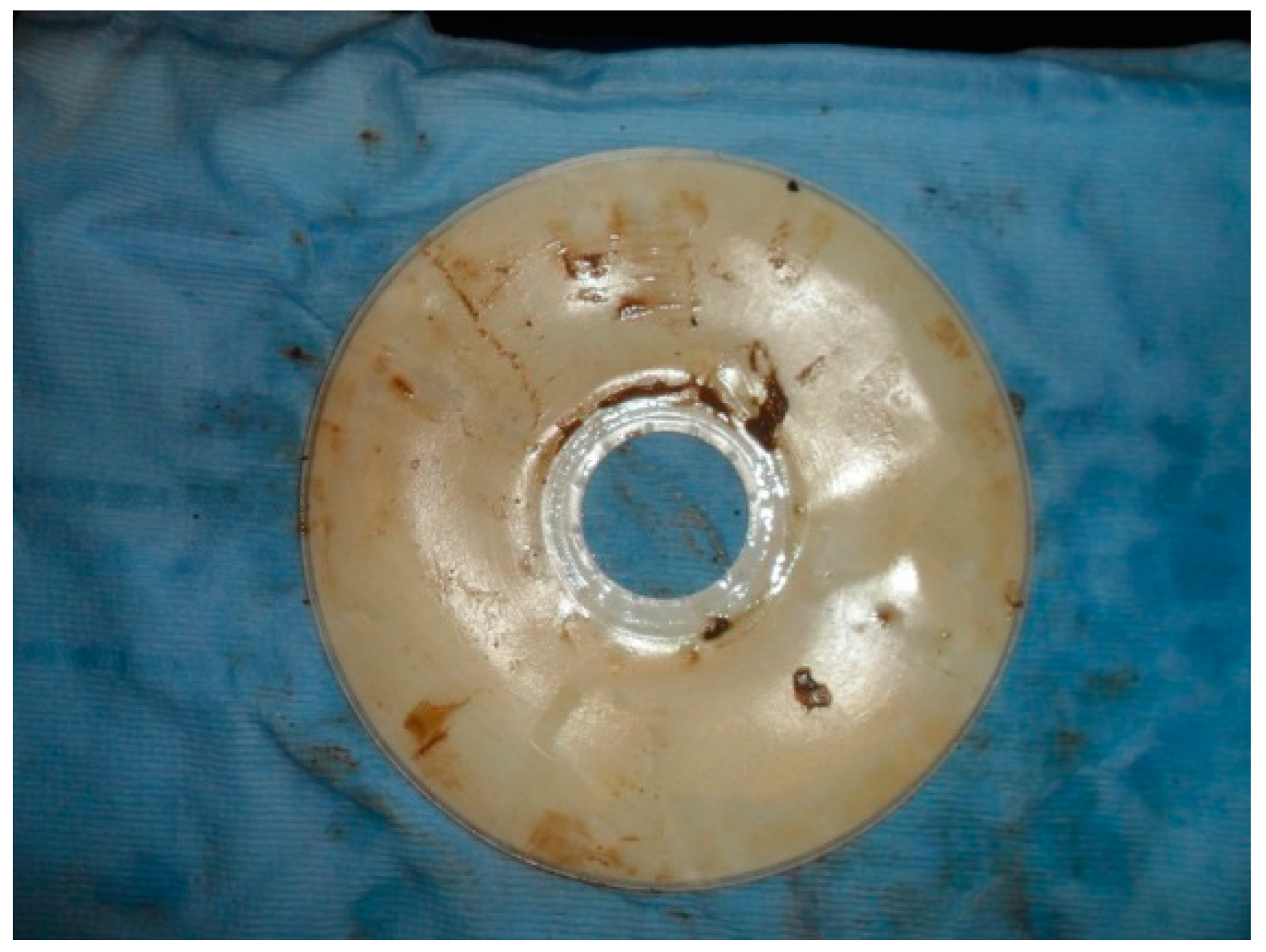 Ijerph 13 00100 g013