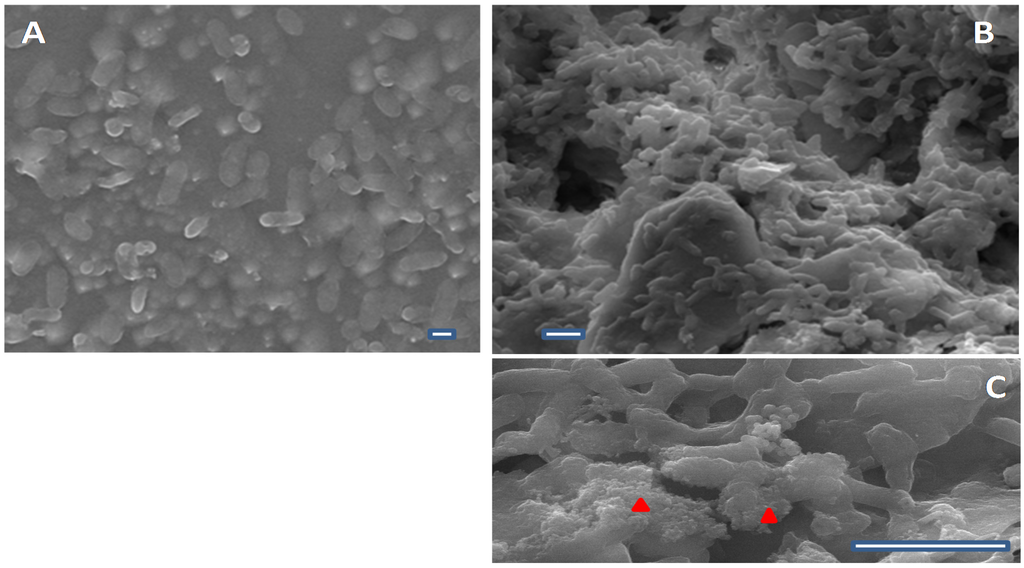 Ijerph 13 00216 g001 1024