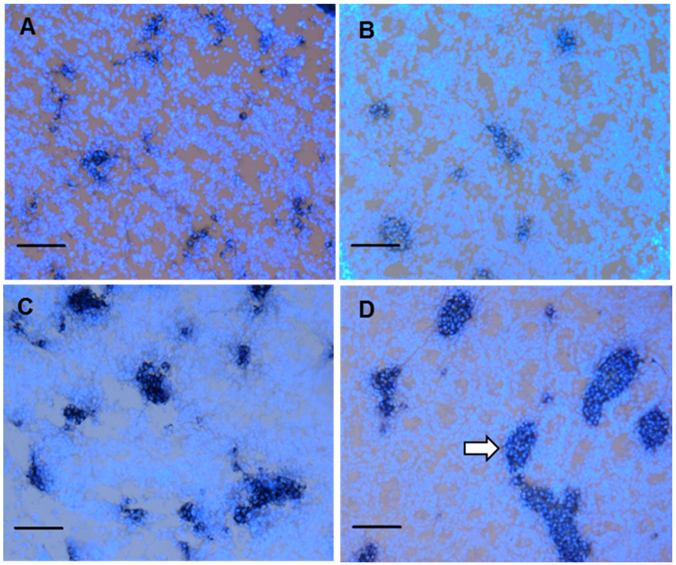 Ijerph 13 00246 g003