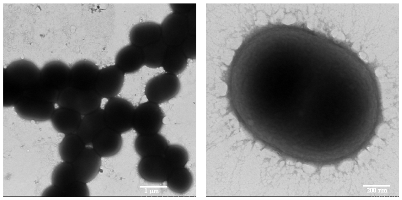 Ijerph 13 00300 g001