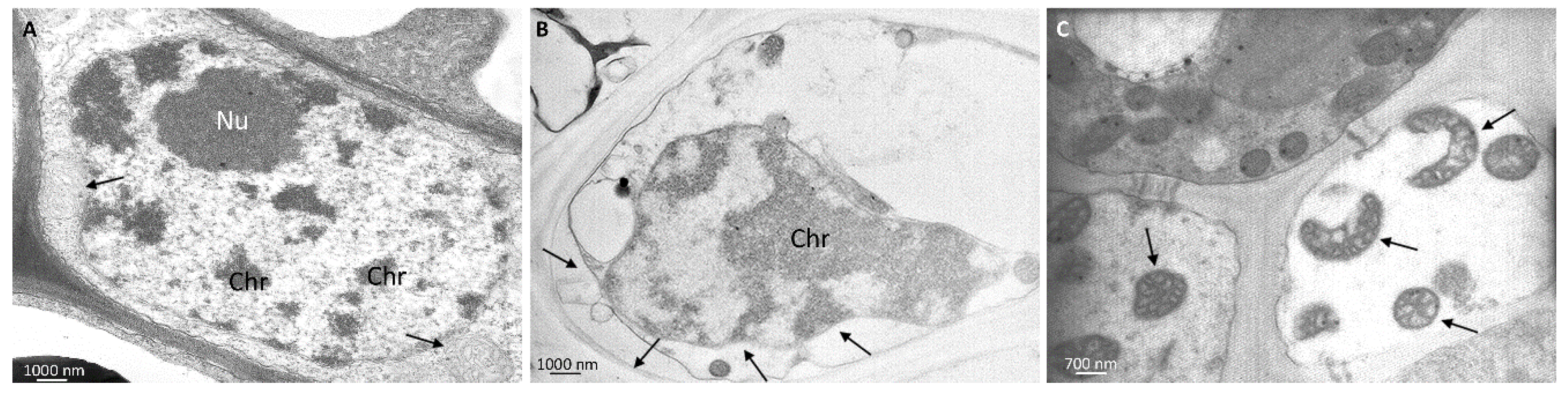 Ijerph 13 00332 g004