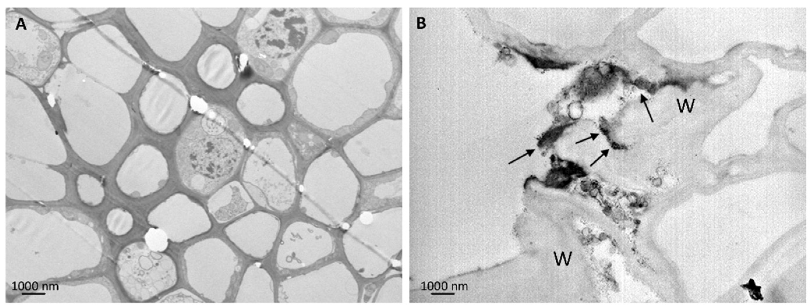 Ijerph 13 00332 g005